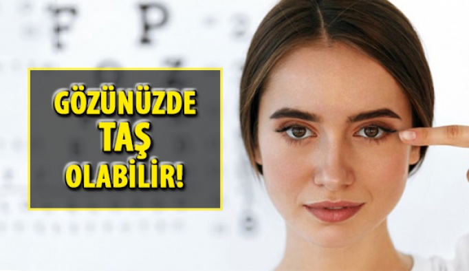 Göz Taşı Nedir? Göz Taşı Belirtileri Nelerdir?