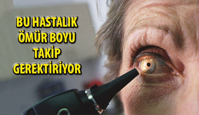 Sarı Nokta Ömür Boyu Takibi Gerektiren Bir Hastalıktır