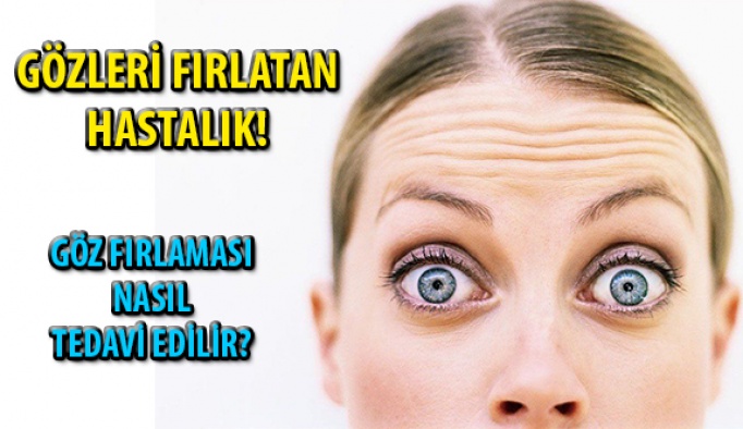 Göz Fırlaması Nasıl Tedavi Edilir?