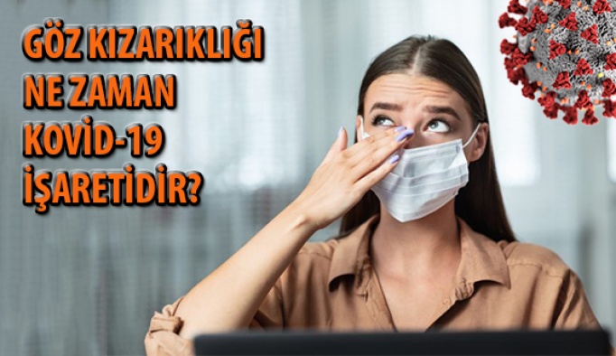 Göz Kızarıklığı Ne Zaman Covid-19 İşareti Olabilir?