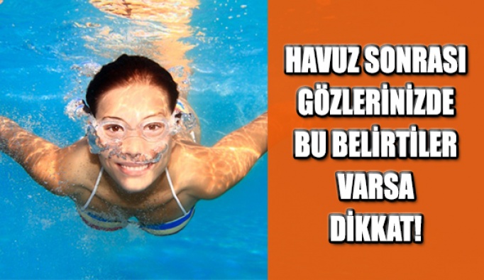 Havuz Sonrası Gözlerinizde Bu Belirtiler Varsa Dikkat!