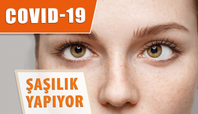 COVID-19 Geçirenlerde Şaşılık Olabilir, Göz Muayenesi Şart