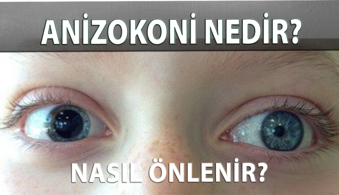 Anizokoni Nedir, Nasıl Önlenir?