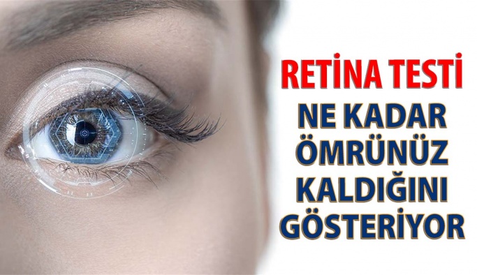 Retina Testi Kalan Ömrünüzü Belirliyor