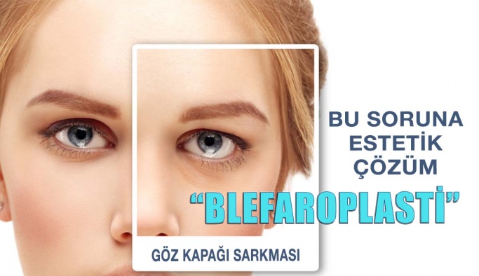 Göz Kapağı Sarkmalarına Estetik Çözüm: “Blefaroplasti”