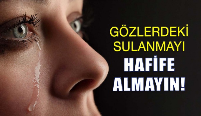 Gözlerdeki Sulanmayı Hafife Almayın!