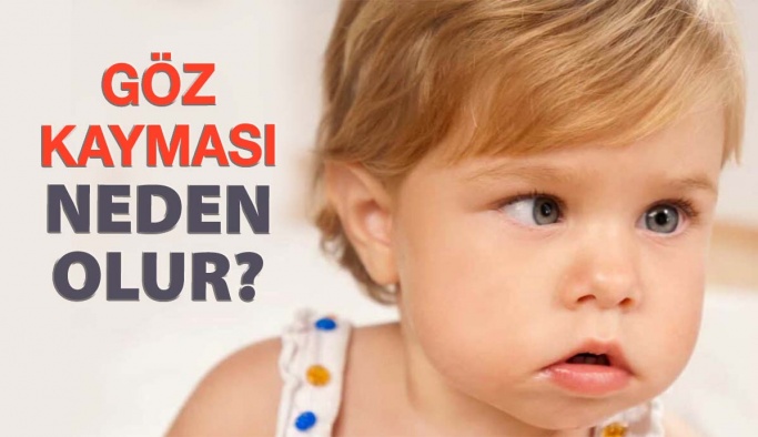 Çocuklarda Göz Kayması Tedavisi Nasıl Yapılır?