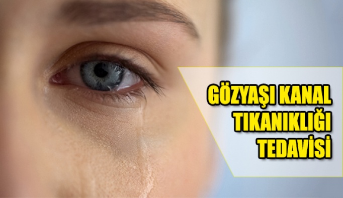 Gözyaşı Kanal Tıkanıklığı Tedavisi Nasıl Yapılır?