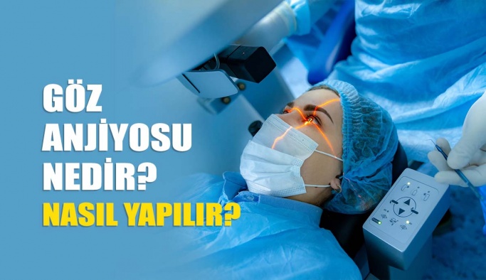 Göz Anjiyosu Nedir? Nasıl Yapılır?