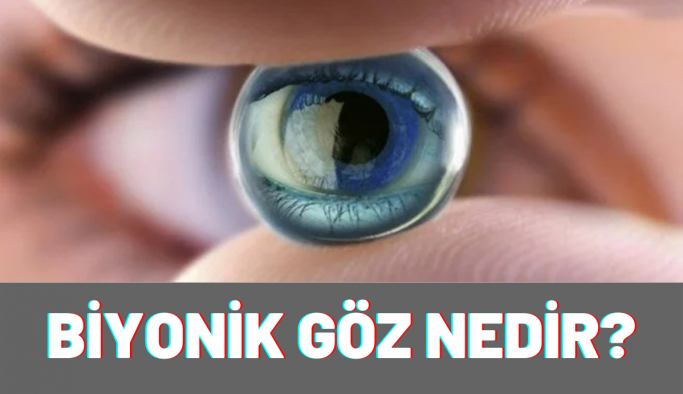 Biyonik Göz Nedir?