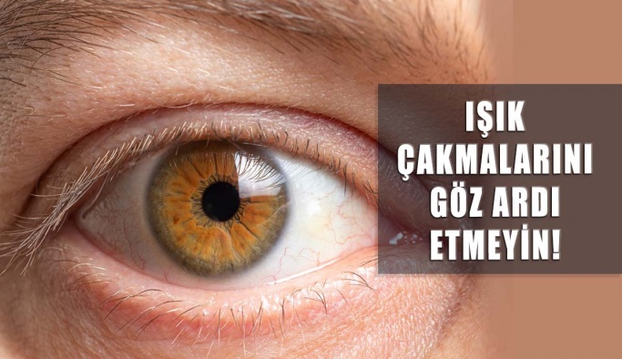 Retina Yırtılması, Işık Çakmalarını Göz Ardı Etmeyin!