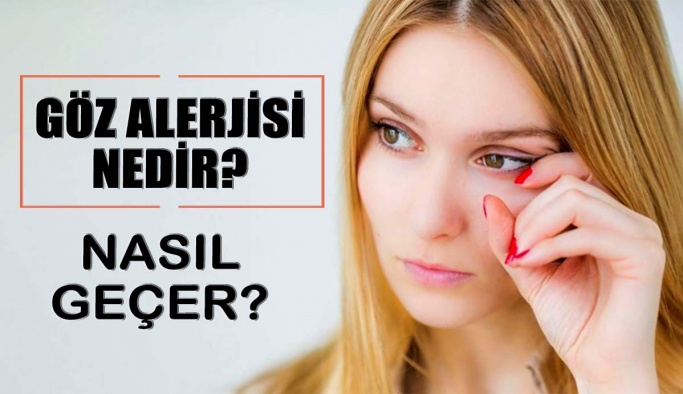 Göz Alerjisi Nedir? Nasıl Geçer?