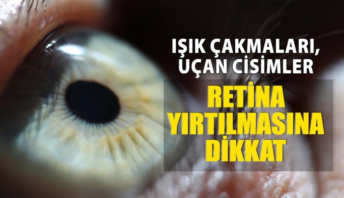 Gözlerde Işık Çakmaları, Uçan Cisimler Retina Yırtılması Habercisi