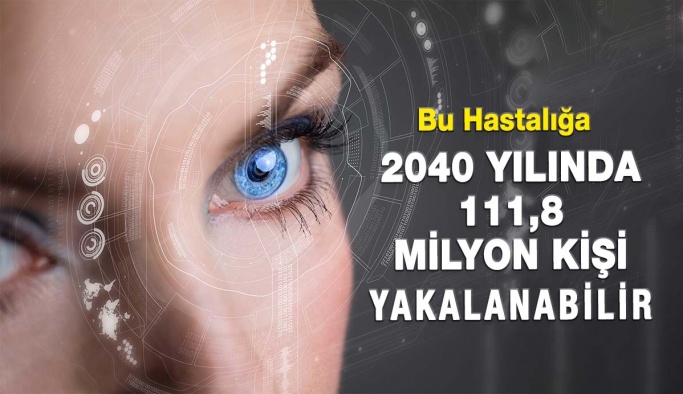 2040 Yılında 111,8 Milyon Kişi Glokom Hastalığına Yakalanabilir