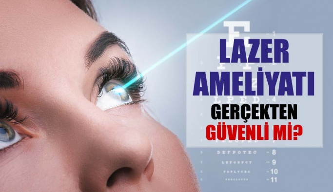 Lazer Ameliyatı Gözler İçin Gerçekten Güvenli Mi?