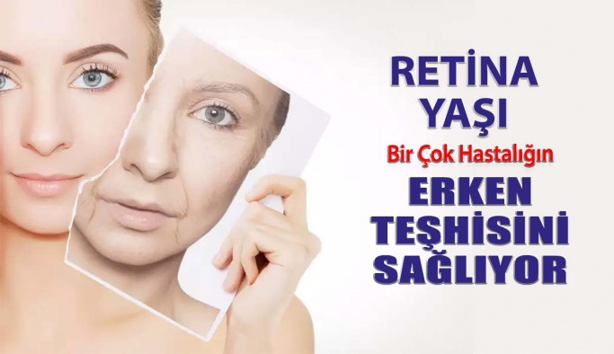 Retina Yaşı Bir Çok Hastalığın Teşhisinde Kullanılabiliyor