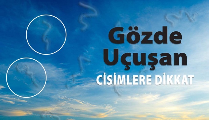 Gözünüzde Uçuşan Cisimler ve Işık Çakmaları Varsa Dikkat!