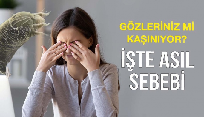 Gözdeki Kaşıntının Asıl Sebebi  Ortaya Çıktı