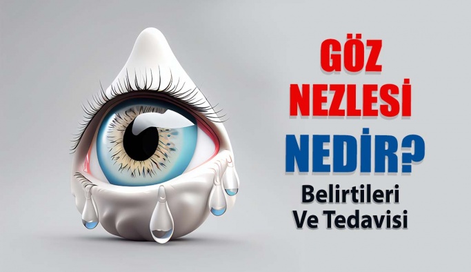 Göz Nezlesi Konjonktivit Nedir? Nasıl Tedavi Edilir?