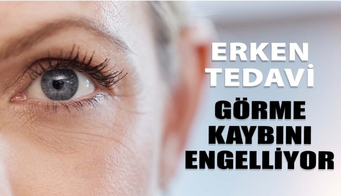 Glokomda Erken Tedavi Görme Kaybını Engelliyor