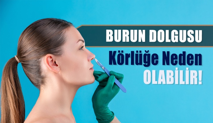 Burun Dolgusu, Görme Kaybına Yol Açabilir