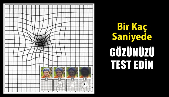 Gözlerinize Birkaç Saniyede Sarı Nokta Hastalığı Testi Yapın