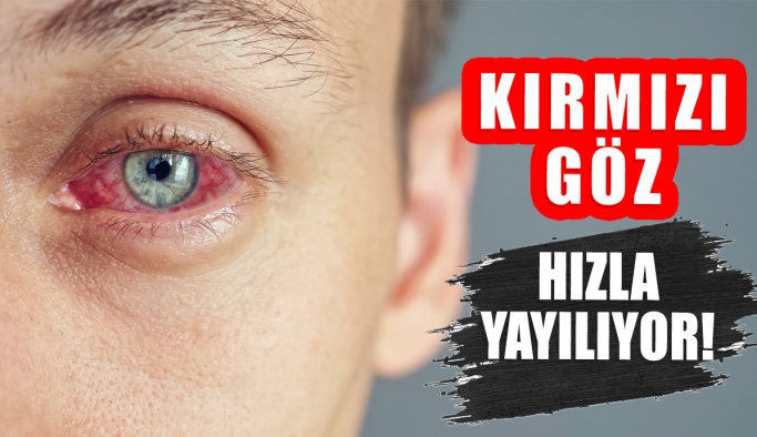 Kırmızı Göz Salgınında Büyük Artış!