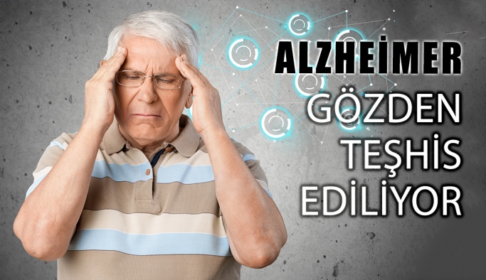 Alzheimer Gözden Erken Teşhis Edilebiliyor