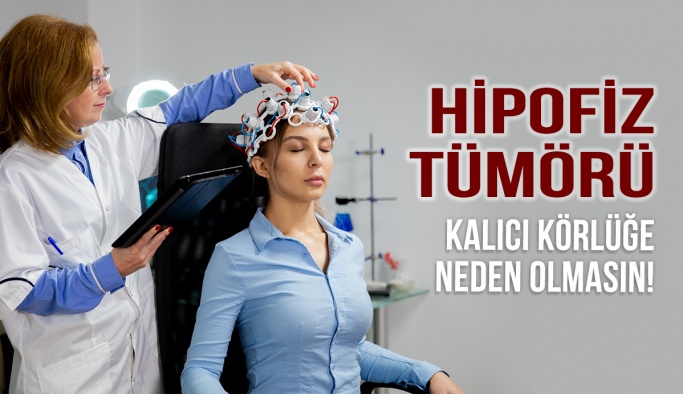 Hipofiz Tümörü Kalıcı Körlüğe Neden Olmasın!