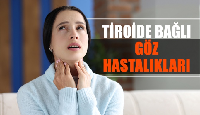 Tiroide Bağlı Göz Hastalıkları