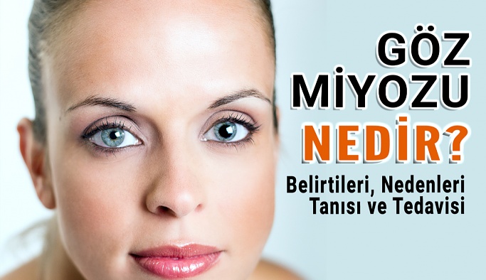 Göz Miyozisi Nedir, Belirtileri, Nedenleri, Tanısı ve Tedavisi