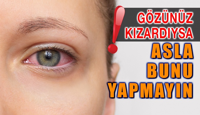 Gözleriniz Kızardıysa Asla Bunu Yapmayın!