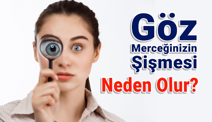 Göz Merceği Neden Şişer?