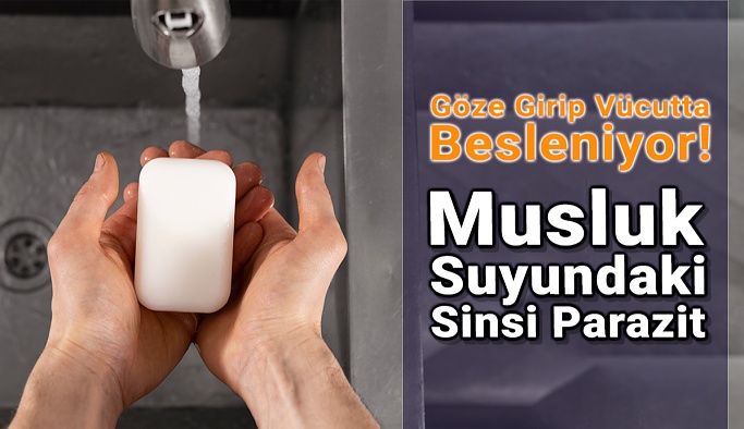 Kontak Lens Kullanıcıları İçin Ciddi Tehdit Oluşturuyor!
