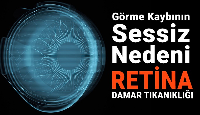 Retina Damar Tıkanıklığı Körlüğe Yol Açabilir