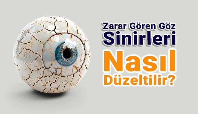 Zarar Gören Göz Sinirleri Nasıl Düzeltilir?