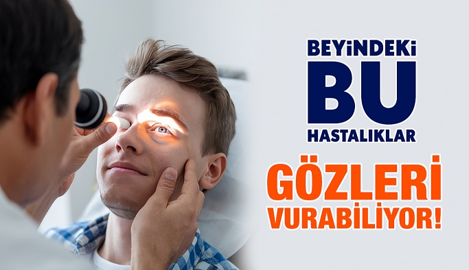 Beyindeki Bu Hastalıklar Gözleri Vurabiliyor!