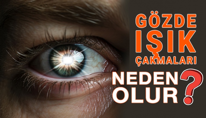 Gözlerde Işık Çakmaları Neden Olur?