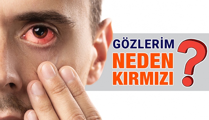 Gözlerim Neden Kırmızı?
