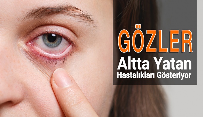 Gözler Altta Yatan Hastalıkları Gösteriyor