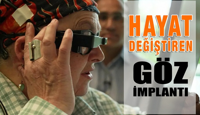 Hayat Değiştiren Göz İmplantı