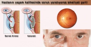 Kimlere Katarakt Ameliyatı Yapılamaz?