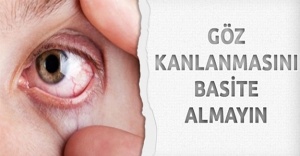 Göz Kanlanmasını Basite Almayın!