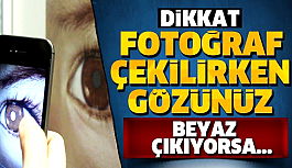 Fotoğrafta beyaz çıkan göz bebeği neyi işaret ediyor?