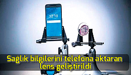 Sağlık bilgilerini telefona aktaran lens geliştirildi