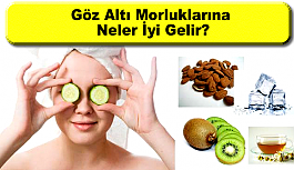 Göz Altı Morlukları Nedir?