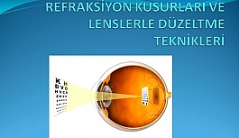 Refraksiyon Kusurları ve Lenslerle Düzeltme Teknikleri