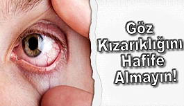 Göz Kızarıklığını Hafife Almayın!