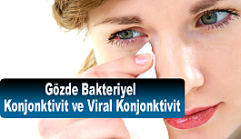 Gözde Bakteriyel  Konjonktivit  ve Viral Konjonktivit