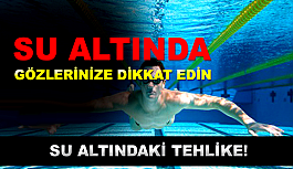 Su Altında Gözlere Dikkat!